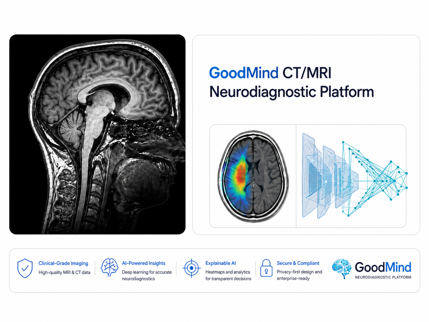 Brain MRI scan — GoodMind neurodiagnostic platform