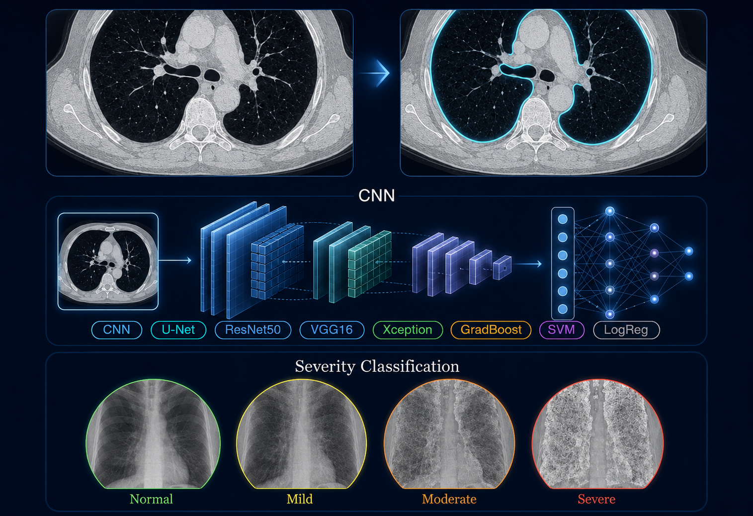 Hybrid deep learning framework — lung CT segmentation and severity classification